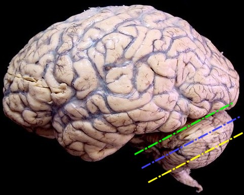 Neuroanatomia